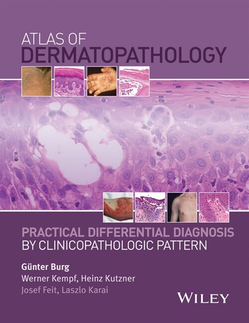 [eBook Code] Atlas of Dermatopathology (eBook Code, 1st)