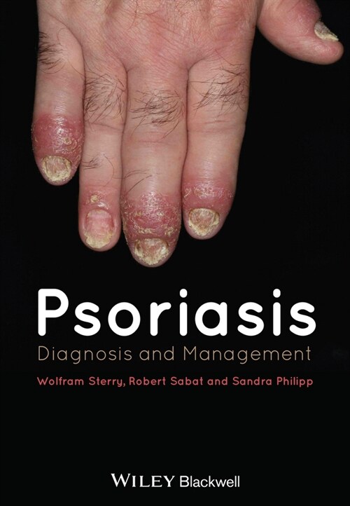 [eBook Code] Psoriasis (eBook Code, 1st)