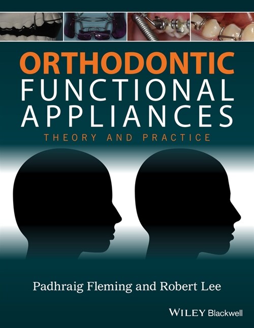 [eBook Code] Orthodontic Functional Appliances (eBook Code, 1st)