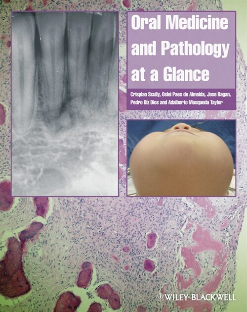 [eBook Code] Oral Medicine and Pathology at a Glance (eBook Code, 1st)