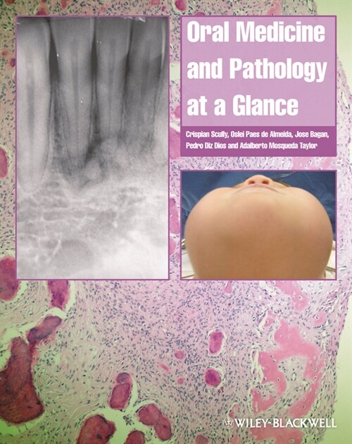[eBook Code] Oral Medicine and Pathology at a Glance (eBook Code, 1st)