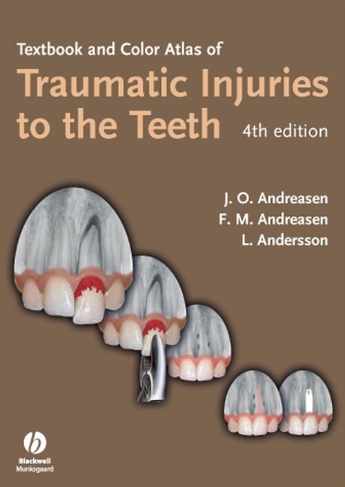[eBook Code] Textbook and Color Atlas of Traumatic Injuries to the Teeth (eBook Code, 4th)