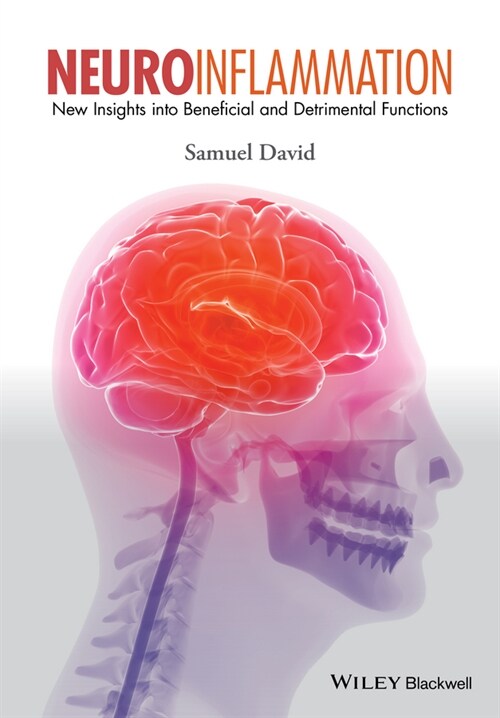 [eBook Code] Neuroinflammation (eBook Code, 1st)