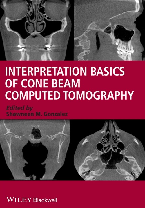 [eBook Code] Interpretation Basics of Cone Beam Computed Tomography (eBook Code, 1st)