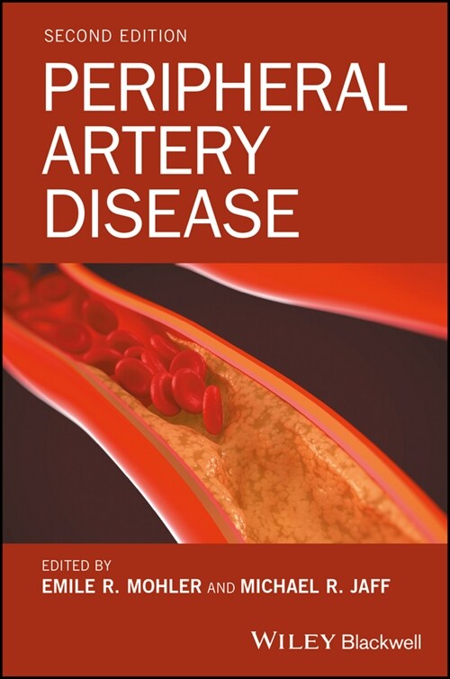 [eBook Code] Peripheral Artery Disease (eBook Code, 2nd)