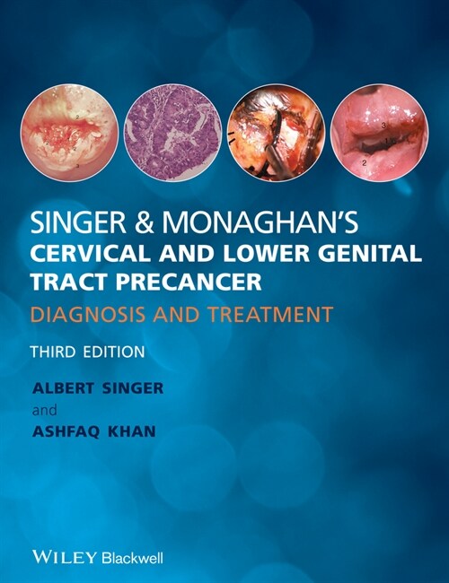 [eBook Code] Singer and Monaghans Cervical and Lower Genital Tract Precancer (eBook Code, 3rd)