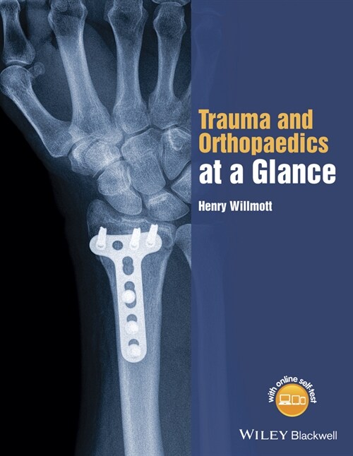 [eBook Code] Trauma and Orthopaedics at a Glance (eBook Code, 1st)