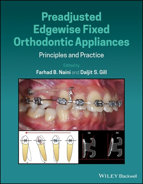 [eBook Code] Preadjusted Edgewise Fixed Orthodontic Appliances (eBook Code, 1st)