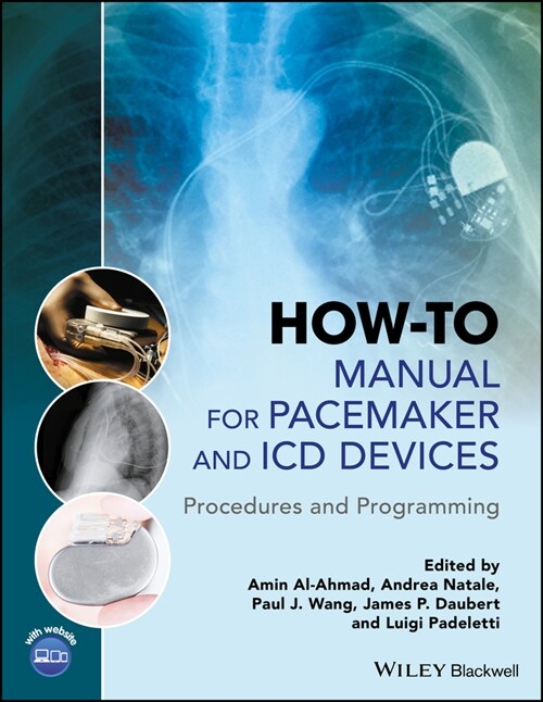 [eBook Code] How-to Manual for Pacemaker and ICD Devices (eBook Code, 1st)