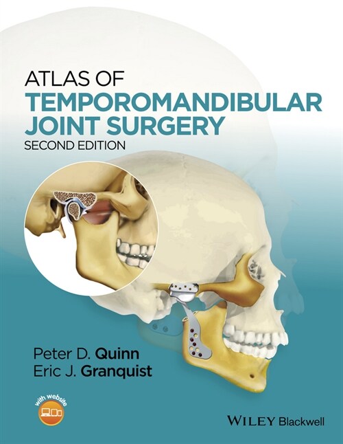 [eBook Code] Atlas of Temporomandibular Joint Surgery (eBook Code, 2nd)