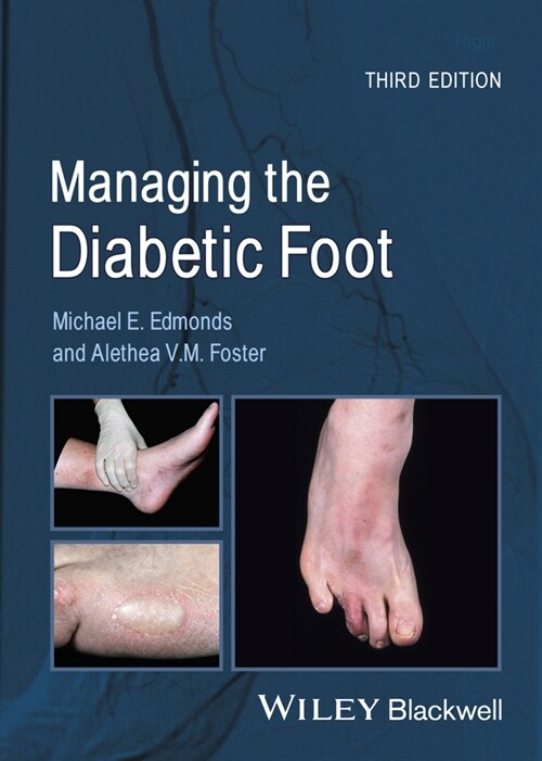 [eBook Code] Managing the Diabetic Foot (eBook Code, 3rd)
