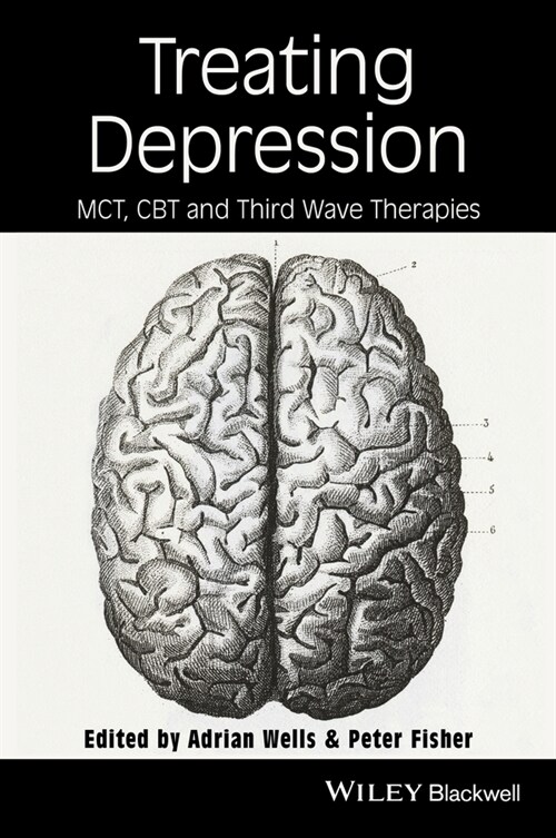 [eBook Code] Treating Depression (eBook Code, 1st)