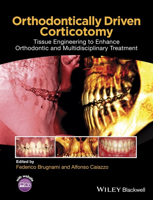 [eBook Code] Orthodontically Driven Corticotomy (eBook Code, 1st)
