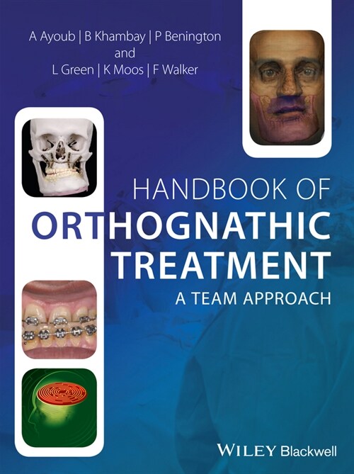 [eBook Code] Handbook of Orthognathic Treatment (eBook Code, 1st)