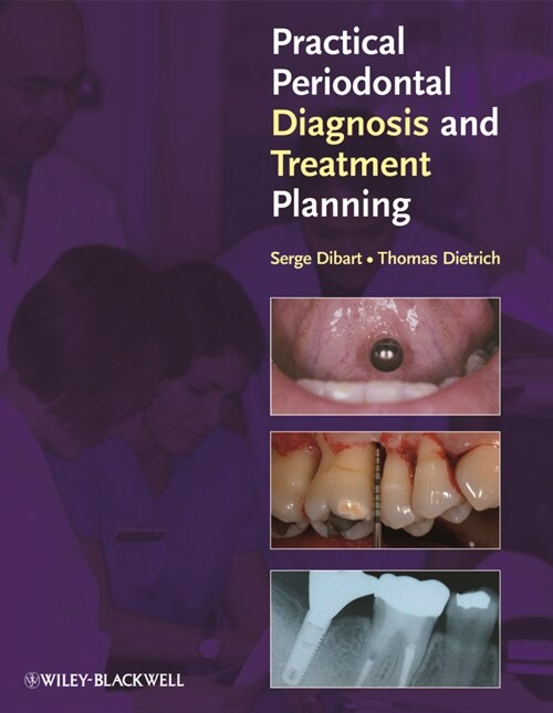 [eBook Code] Practical Periodontal Diagnosis and Treatment Planning (eBook Code, 1st)