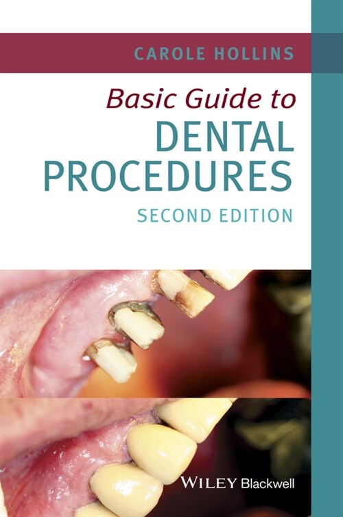 [eBook Code] Basic Guide to Dental Procedures (eBook Code, 2nd)