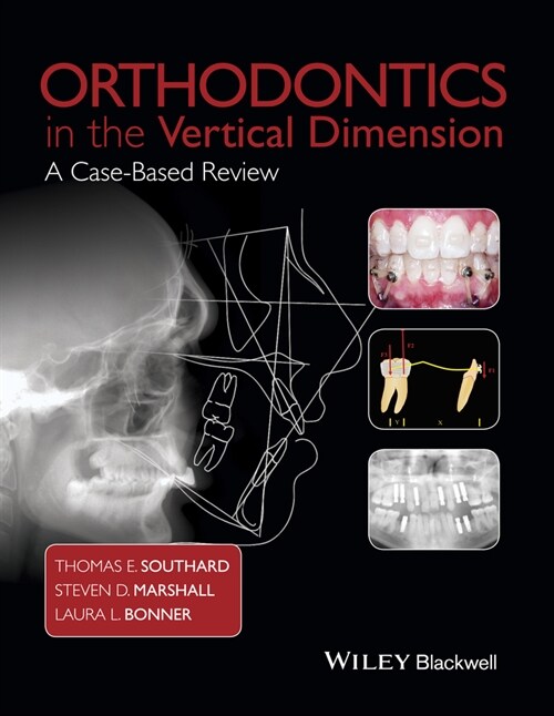 [eBook Code] Orthodontics in the Vertical Dimension (eBook Code, 1st)