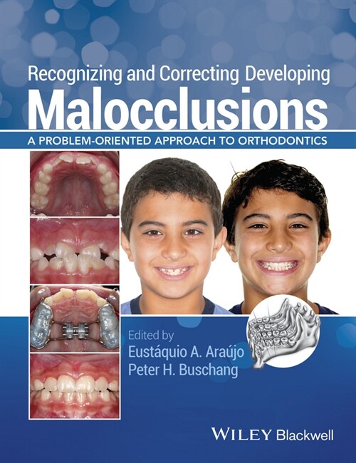 [eBook Code] Recognizing and Correcting Developing Malocclusions (eBook Code, 1st)