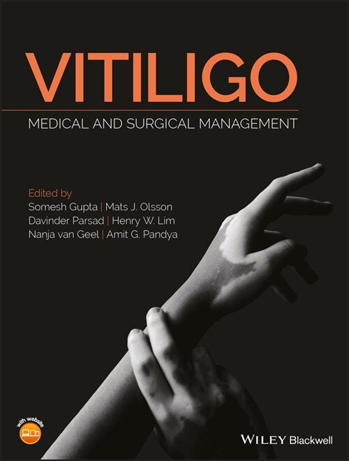 [eBook Code] Vitiligo (eBook Code, 1st)