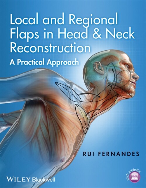 [eBook Code] Local and Regional Flaps in Head and Neck Reconstruction (eBook Code, 1st)