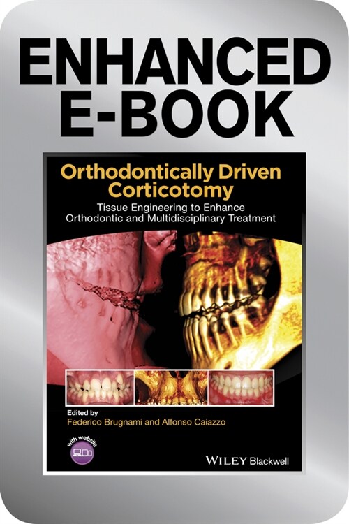 [eBook Code] Orthodontically Driven Corticotomy (eBook Code, 1st)