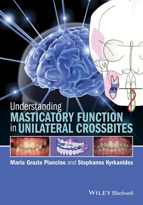 [eBook Code] Understanding Masticatory Function in Unilateral Crossbites (eBook Code, 1st)