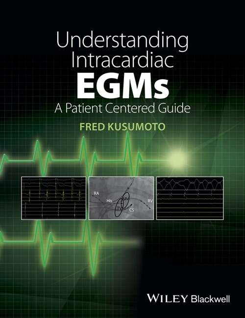 [eBook Code] Understanding Intracardiac EGMs (eBook Code, 1st)