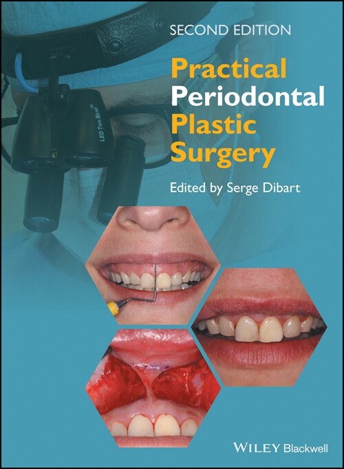 [eBook Code] Practical Periodontal Plastic Surgery (eBook Code, 2nd)