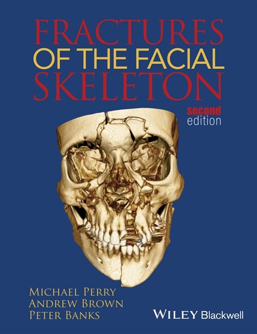 [eBook Code] Fractures of the Facial Skeleton (eBook Code, 2nd)