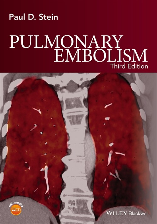 [eBook Code] Pulmonary Embolism (eBook Code, 3rd)