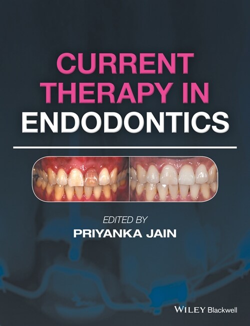 [eBook Code] Current Therapy in Endodontics (eBook Code, 1st)