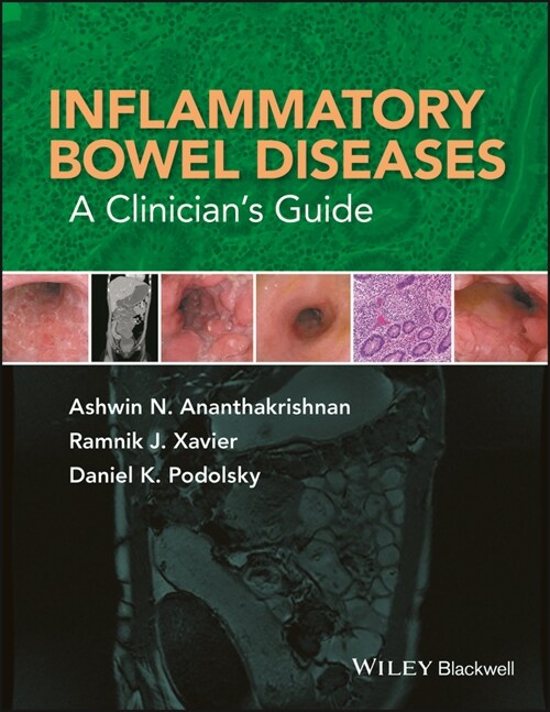 [eBook Code] Inflammatory Bowel Diseases (eBook Code, 1st)