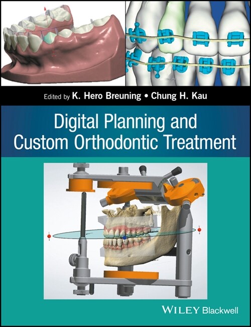 [eBook Code] Digital Planning and Custom Orthodontic Treatment (eBook Code, 1st)