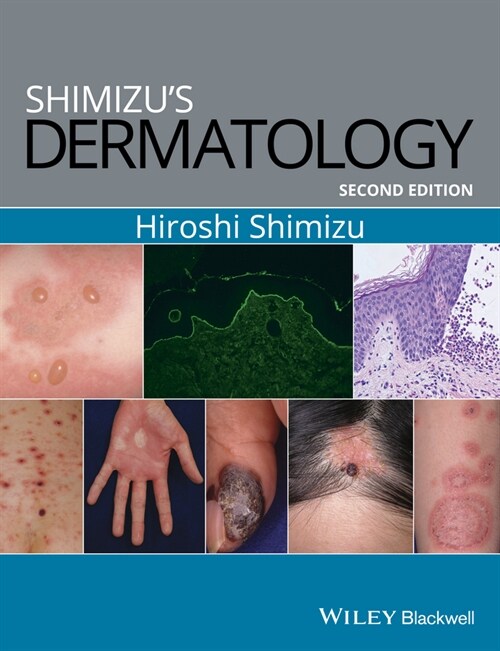 [eBook Code] Shimizus Dermatology (eBook Code, 2nd)