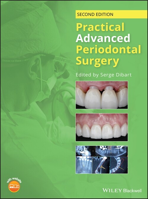 [eBook Code] Practical Advanced Periodontal Surgery (eBook Code, 2nd)