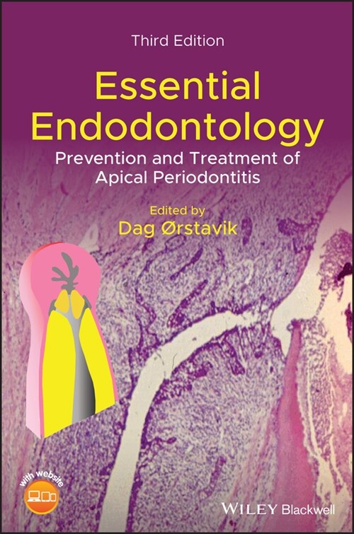 [eBook Code] Essential Endodontology (eBook Code, 3rd)