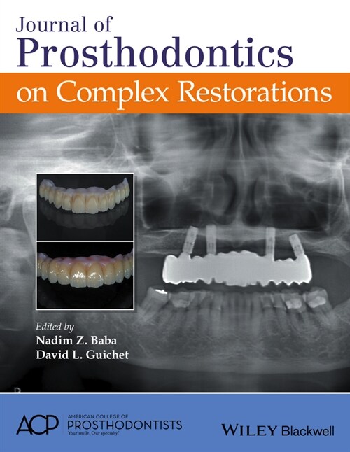 [eBook Code] Journal of Prosthodontics on Complex Restorations (eBook Code, 1st)