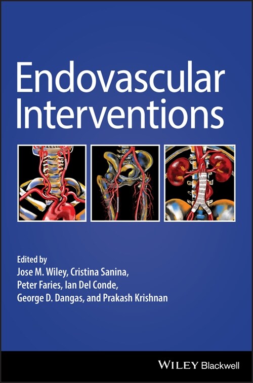 [eBook Code] Endovascular Interventions (eBook Code, 1st)