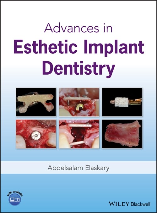 [eBook Code] Advances in Esthetic Implant Dentistry (eBook Code, 1st)
