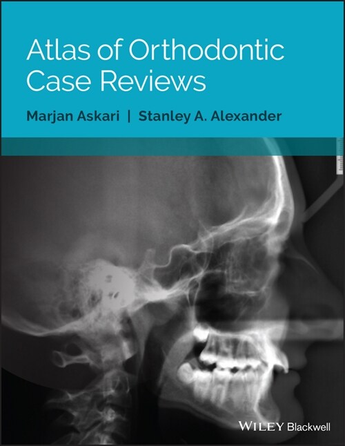 [eBook Code] Atlas of Orthodontic Case Reviews (eBook Code, 1st)