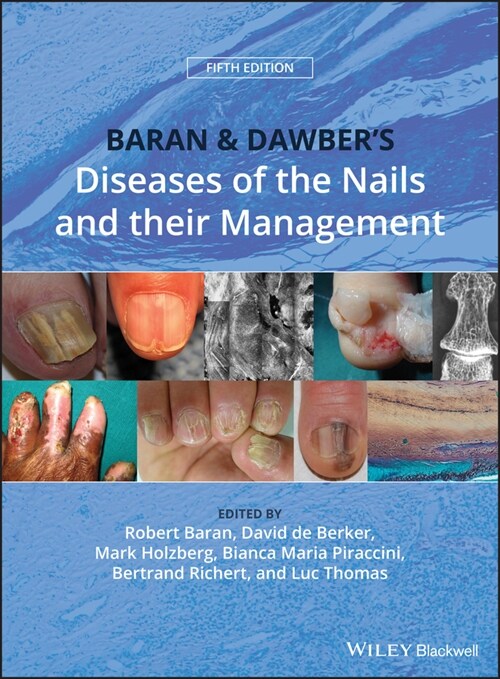[eBook Code] Baran and Dawbers Diseases of the Nails and their Management (eBook Code, 5th)