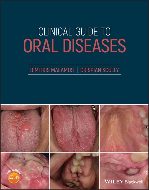 [eBook Code] Clinical Guide to Oral Diseases (eBook Code, 1st)