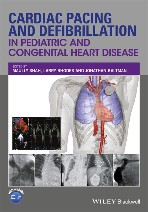 [eBook Code] Cardiac Pacing and Defibrillation in Pediatric and Congenital Heart Disease (eBook Code, 1st)