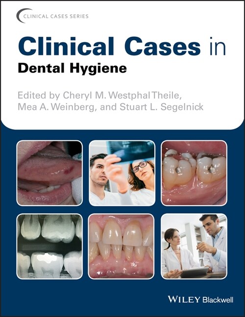 [eBook Code] Clinical Cases in Dental Hygiene (eBook Code, 1st)