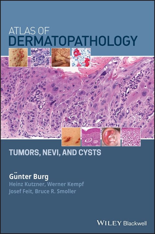 [eBook Code] Atlas of Dermatopathology (eBook Code, 1st)