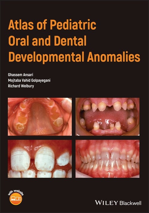 [eBook Code] Atlas of Pediatric Oral and Dental Developmental Anomalies (eBook Code, 1st)