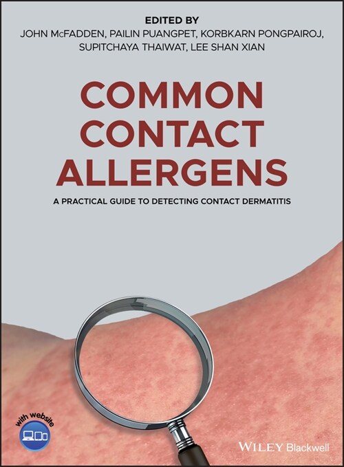 [eBook Code] Common Contact Allergens (eBook Code, 1st)