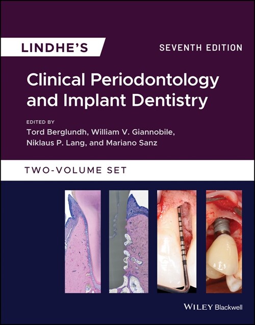 [eBook Code] Lindhes Clinical Periodontology and Implant Dentistry (eBook Code, 7th)