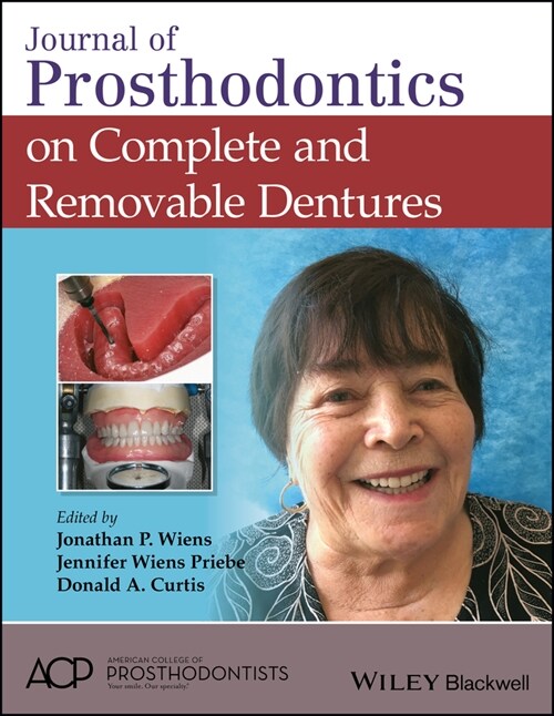 [eBook Code] Journal of Prosthodontics on Complete and Removable Dentures (eBook Code, 1st)