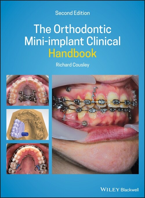 [eBook Code] The Orthodontic Mini-implant Clinical Handbook (eBook Code, 2nd)